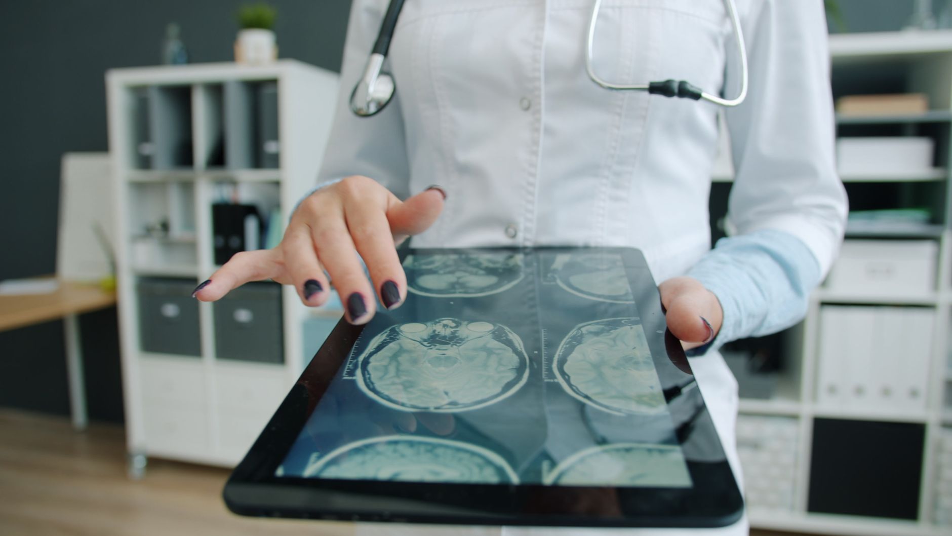 Doctor reviewing digital brain scans on a tablet in a medical office setting.